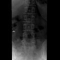 best hospitals Germany Spine